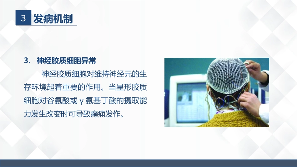 神经内科-癫痫的护理查房_第12页