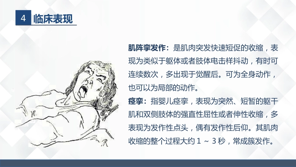 神经内科-癫痫的护理查房_第15页