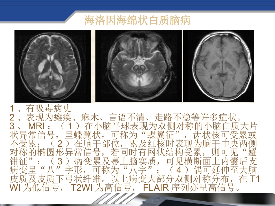 Fahr's病及鉴别_第9页