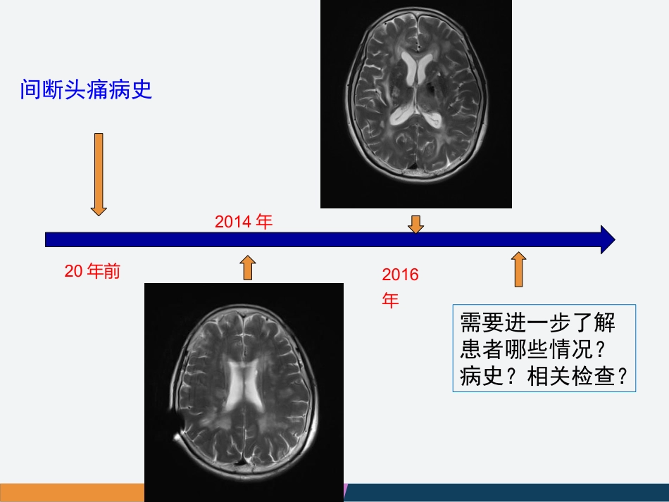 病例汇报：一位53岁反复卒中的女性患者_第14页
