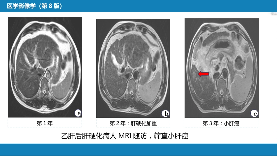 第一章 影像诊断学总论 第八节 图像的观察和分析与影像诊断原则；第九节 影像检查的申请和影像诊断报告的应用；第十节 图像存档和传输系统与信息放射学_第12页