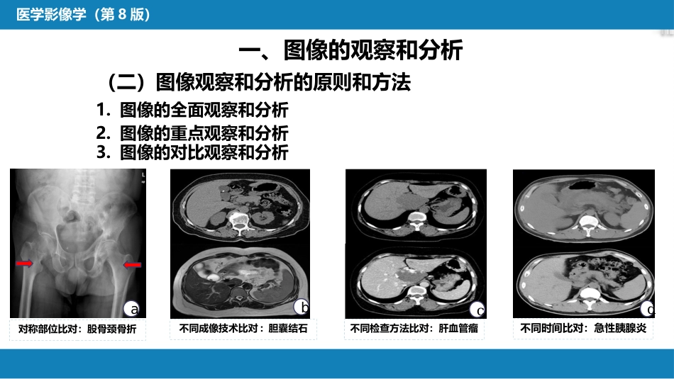 第一章 影像诊断学总论 第八节 图像的观察和分析与影像诊断原则；第九节 影像检查的申请和影像诊断报告的应用；第十节 图像存档和传输系统与信息放射学_第6页