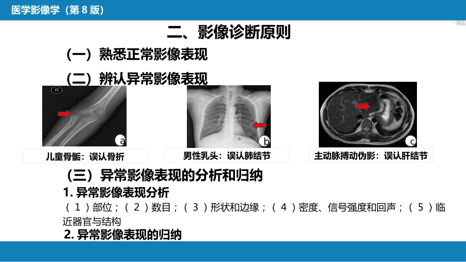 第一章 影像诊断学总论 第八节 图像的观察和分析与影像诊断原则；第九节 影像检查的申请和影像诊断报告的应用；第十节 图像存档和传输系统与信息放射学_第7页