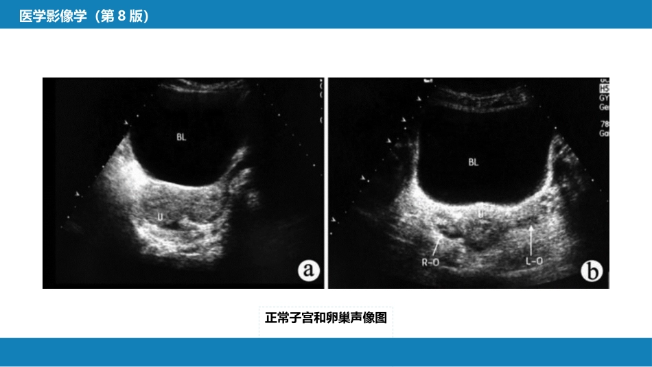 第八章 泌尿生殖系统与腹膜后间隙 第三节 女性生殖系统_第10页