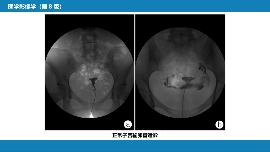 第八章 泌尿生殖系统与腹膜后间隙 第三节 女性生殖系统_第8页