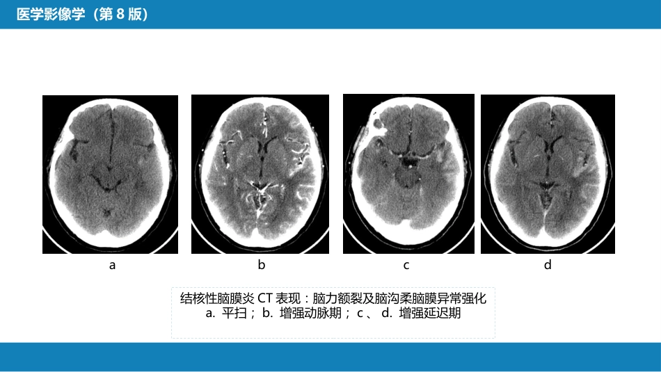 第二章 中枢神经系统 第三节 基本病变表现_第11页