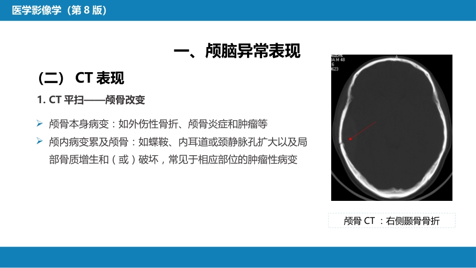 第二章 中枢神经系统 第三节 基本病变表现_第9页