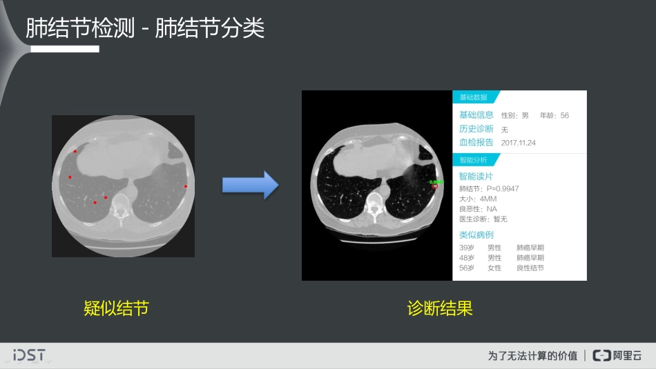 大数据视觉智能实践及医学影像智能诊断探索_第10页