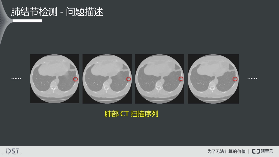 大数据视觉智能实践及医学影像智能诊断探索_第3页