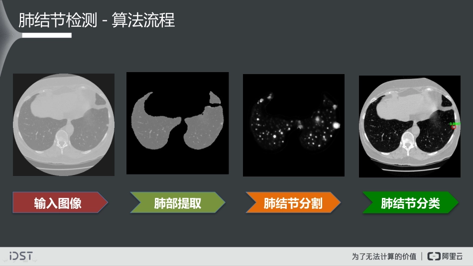 大数据视觉智能实践及医学影像智能诊断探索_第4页