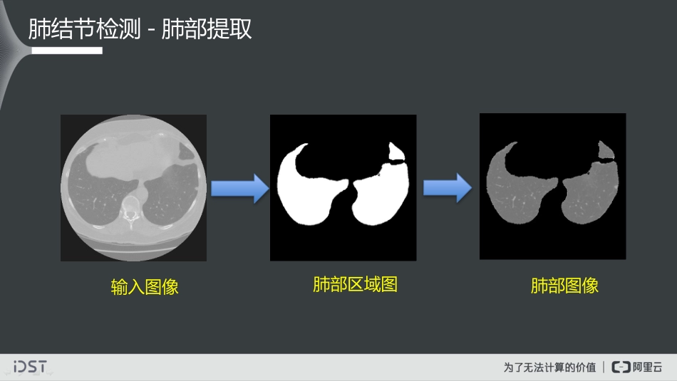 大数据视觉智能实践及医学影像智能诊断探索_第6页
