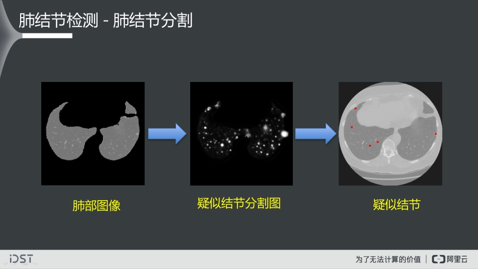 大数据视觉智能实践及医学影像智能诊断探索_第8页