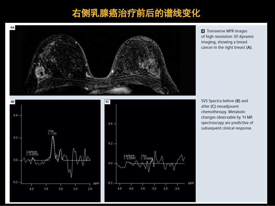 乳腺影像学检查与诊断_第15页