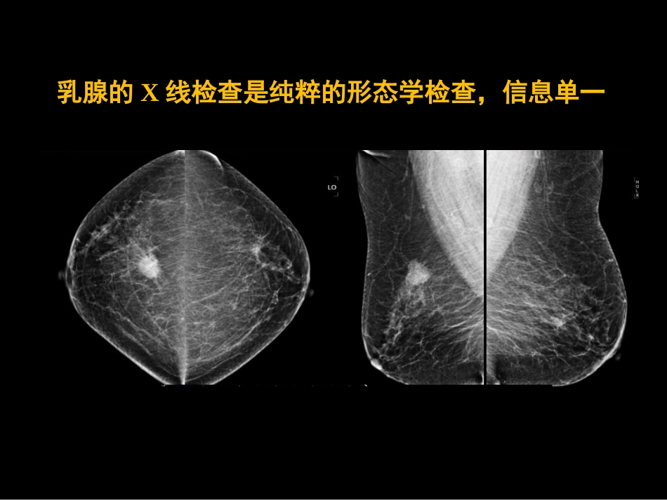 乳腺影像学检查与诊断_第7页