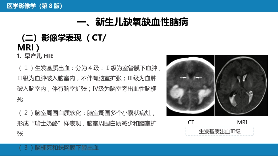 第十章 儿科影像学_第12页