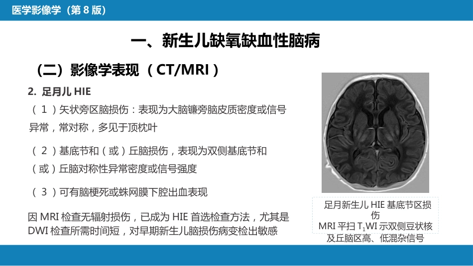 第十章 儿科影像学_第13页