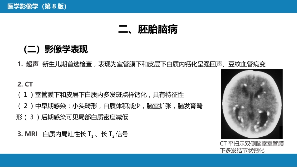 第十章 儿科影像学_第15页