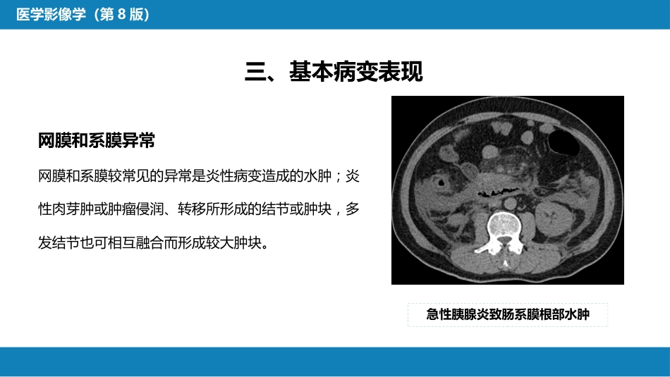 第七章 消化系统与腹膜腔 第三节 腹膜腔和肠系膜_第10页