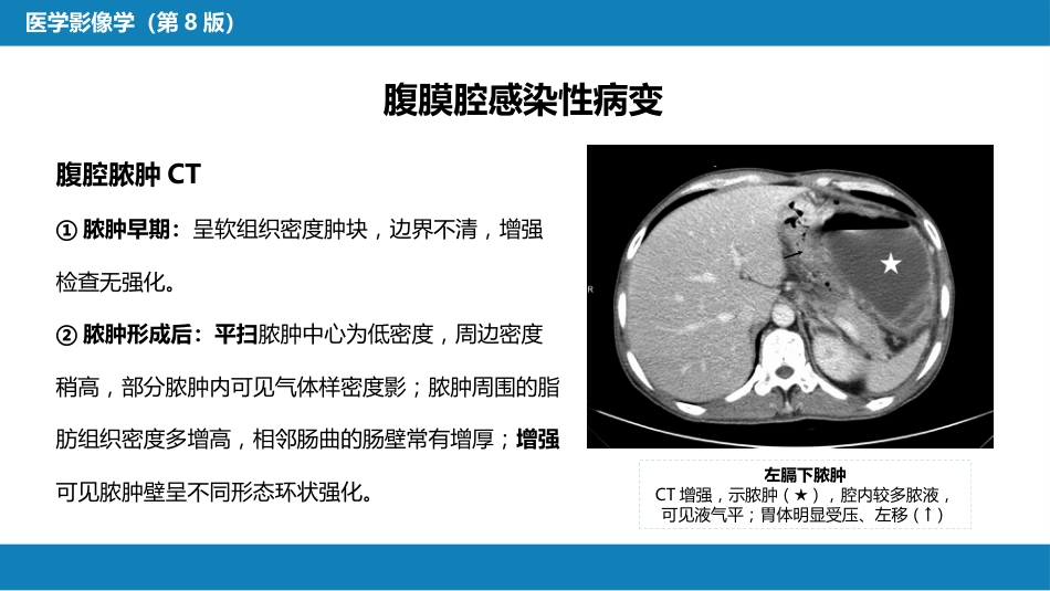 第七章 消化系统与腹膜腔 第三节 腹膜腔和肠系膜_第12页