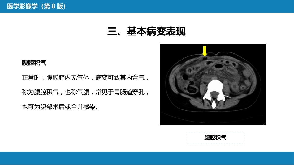 第七章 消化系统与腹膜腔 第三节 腹膜腔和肠系膜_第7页
