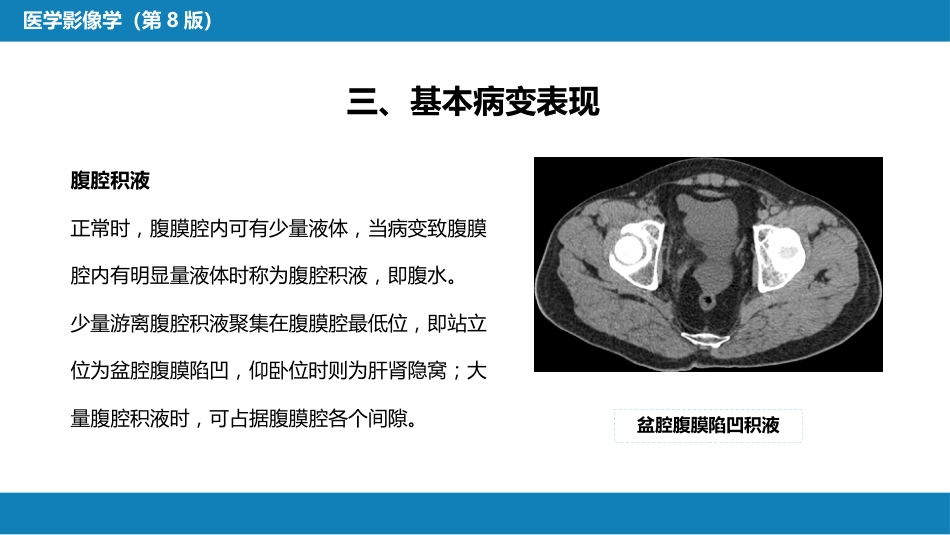 第七章 消化系统与腹膜腔 第三节 腹膜腔和肠系膜_第8页