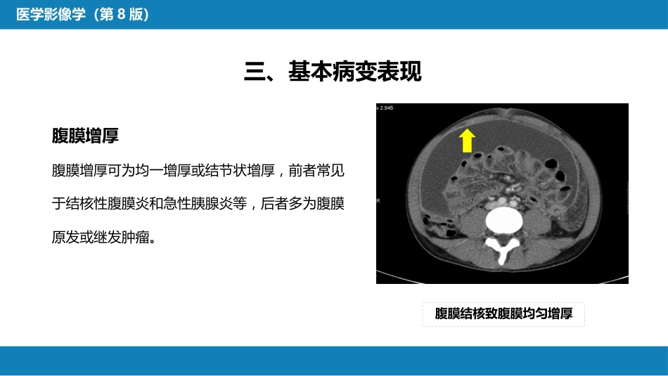第七章 消化系统与腹膜腔 第三节 腹膜腔和肠系膜_第9页