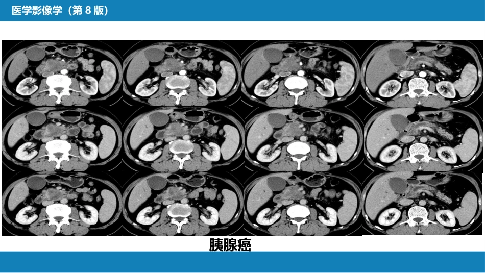 第七章 消化系统与腹膜腔 第二节 胰腺、脾_第11页