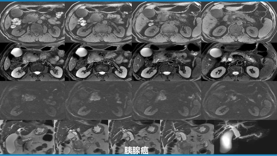 第七章 消化系统与腹膜腔 第二节 胰腺、脾_第12页