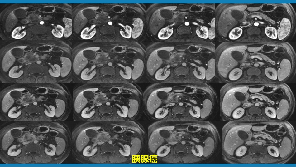 第七章 消化系统与腹膜腔 第二节 胰腺、脾_第13页