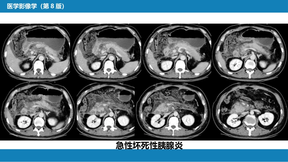 第七章 消化系统与腹膜腔 第二节 胰腺、脾_第7页