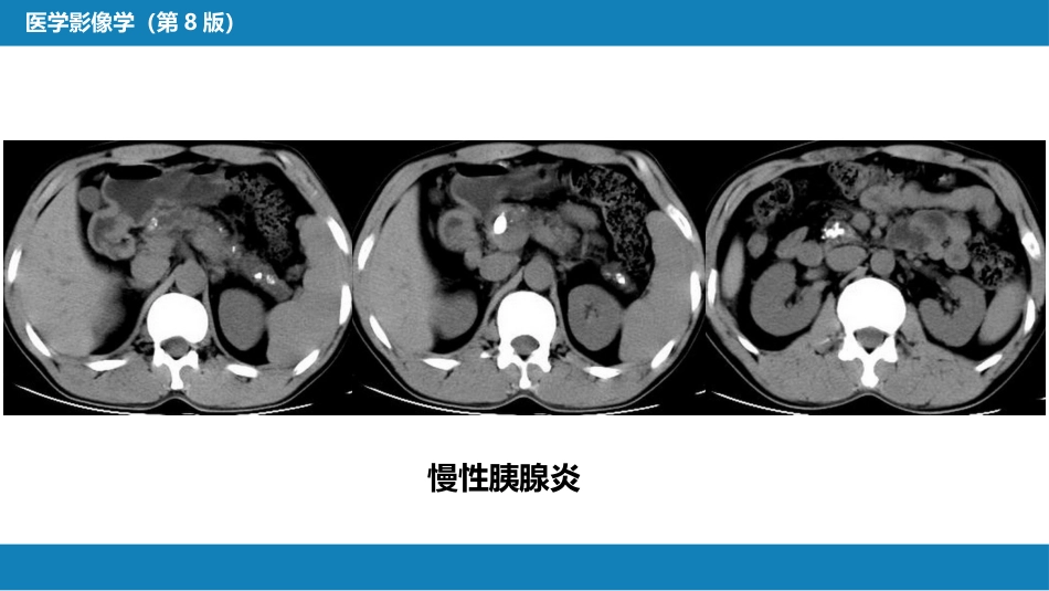 第七章 消化系统与腹膜腔 第二节 胰腺、脾_第9页