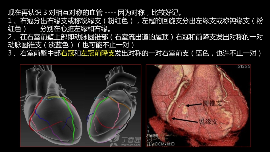 多层螺旋CT冠状动脉疾病诊断再学习之一_第10页