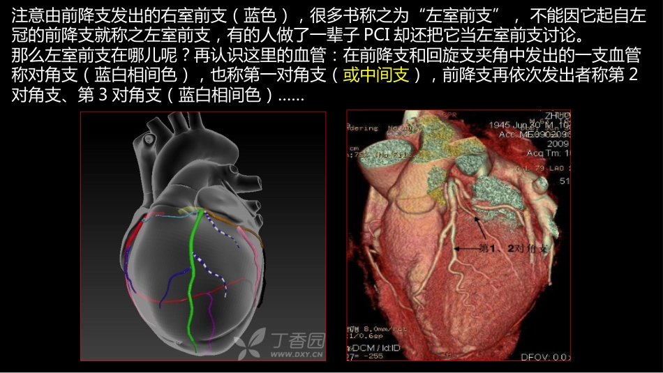 多层螺旋CT冠状动脉疾病诊断再学习之一_第11页