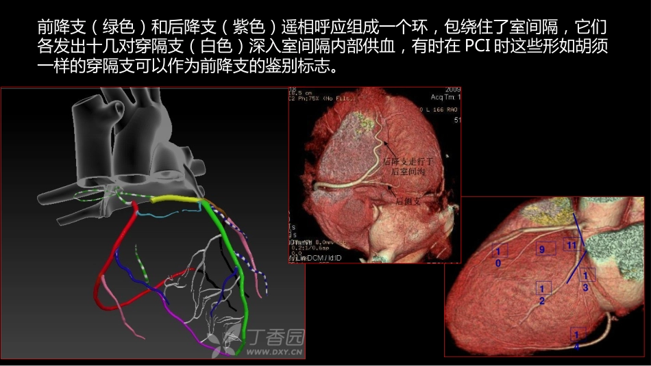 多层螺旋CT冠状动脉疾病诊断再学习之一_第13页