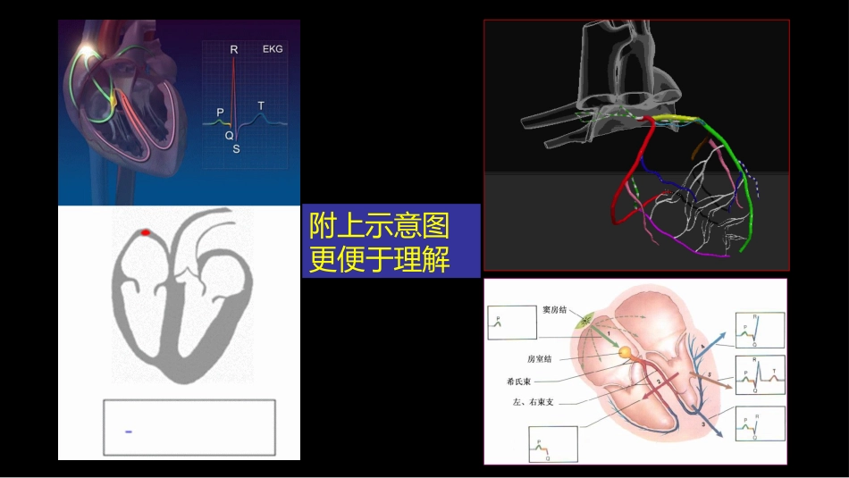 多层螺旋CT冠状动脉疾病诊断再学习之一_第15页
