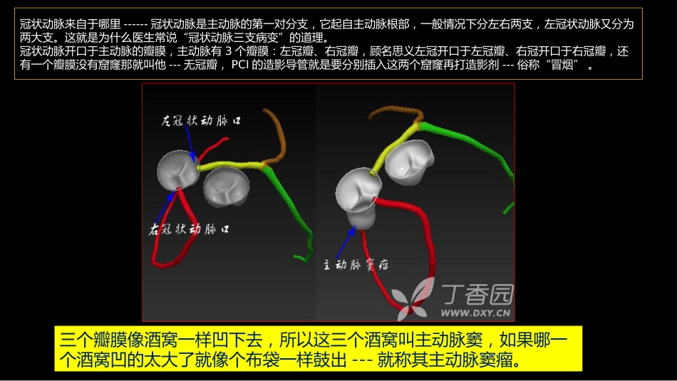 多层螺旋CT冠状动脉疾病诊断再学习之一_第5页