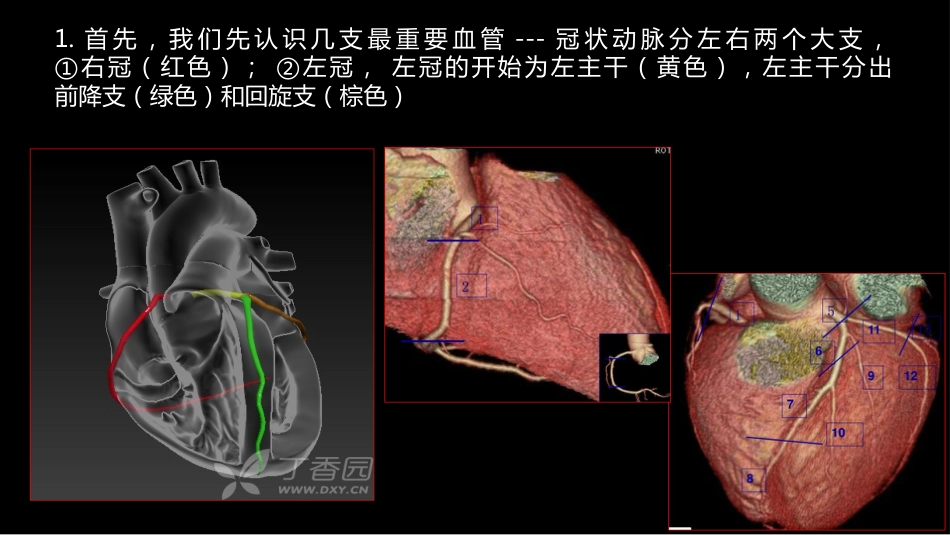 多层螺旋CT冠状动脉疾病诊断再学习之一_第6页