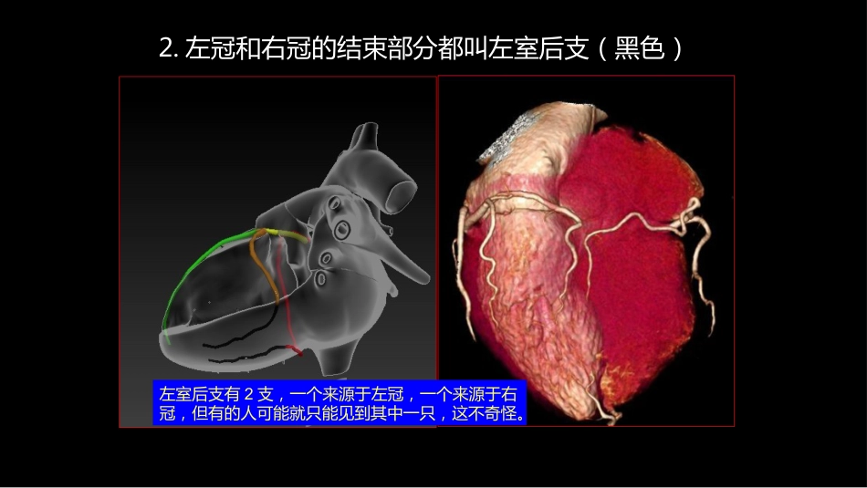 多层螺旋CT冠状动脉疾病诊断再学习之一_第7页