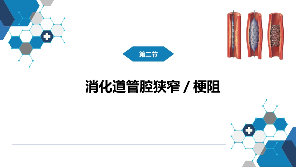 第十四章 非血管疾病介入治疗_第12页