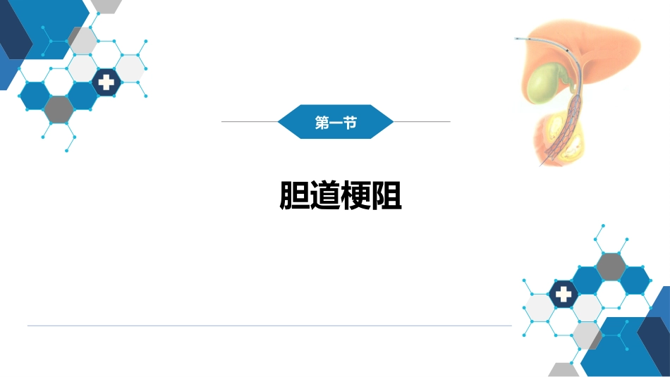 第十四章 非血管疾病介入治疗_第4页