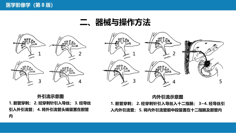第十四章 非血管疾病介入治疗_第7页