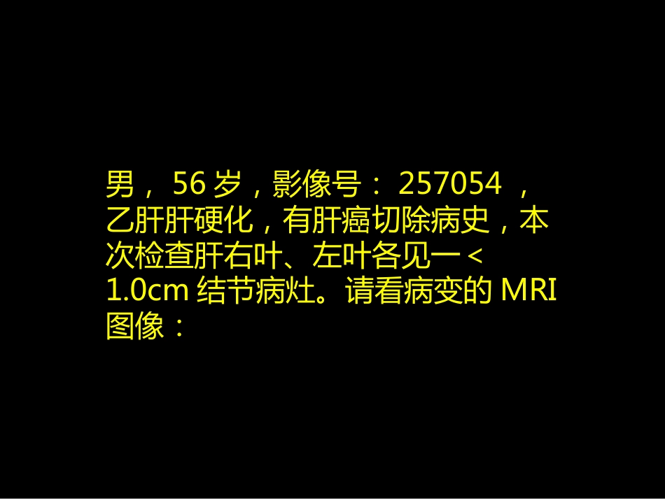 微小肝癌-MR诊断_第11页