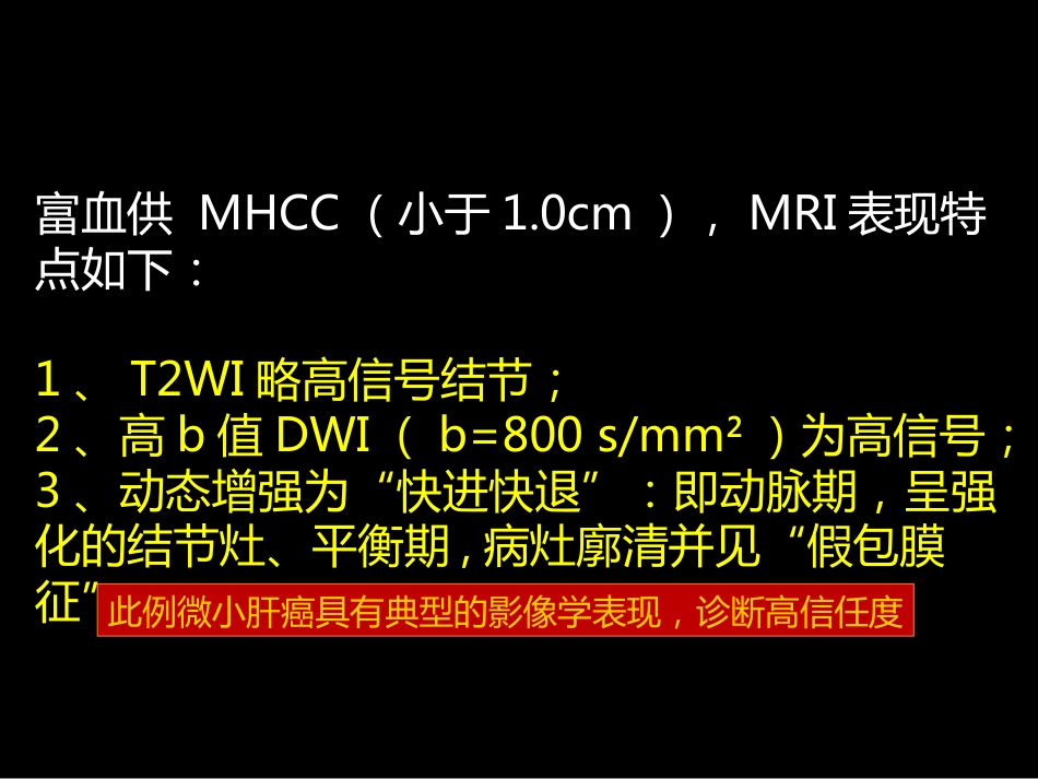 微小肝癌-MR诊断_第14页