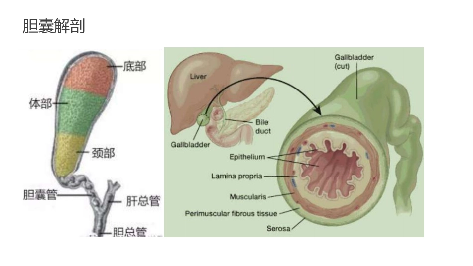 胆囊癌影像_第5页