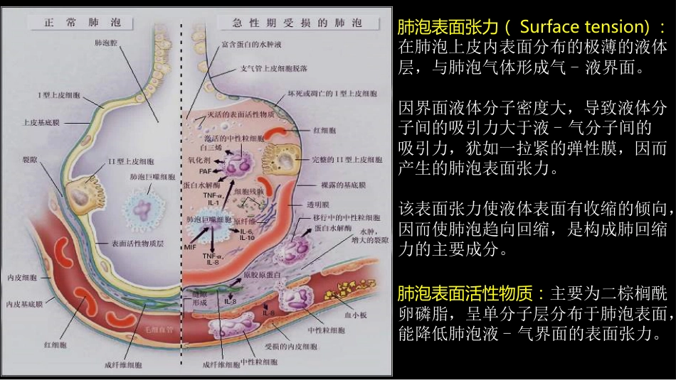 急性呼吸窘迫综合征(ARDS)的-影像学表现_第9页