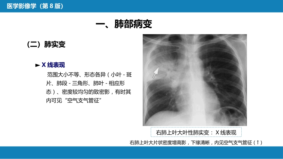 第四章 呼吸系统 第三节 基本病变表现_第10页