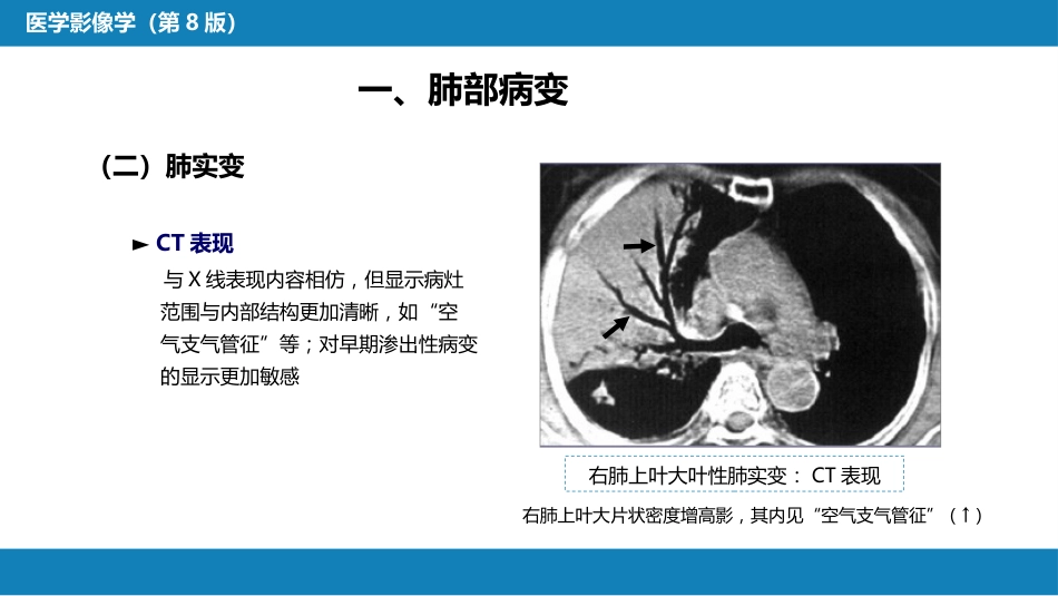 第四章 呼吸系统 第三节 基本病变表现_第11页