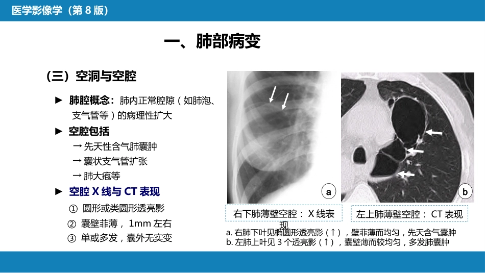 第四章 呼吸系统 第三节 基本病变表现_第15页