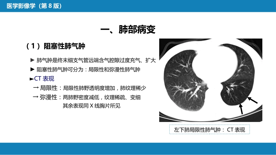 第四章 呼吸系统 第三节 基本病变表现_第6页