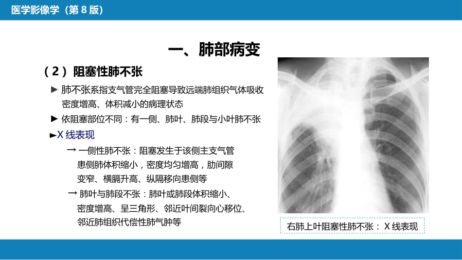 第四章 呼吸系统 第三节 基本病变表现_第7页